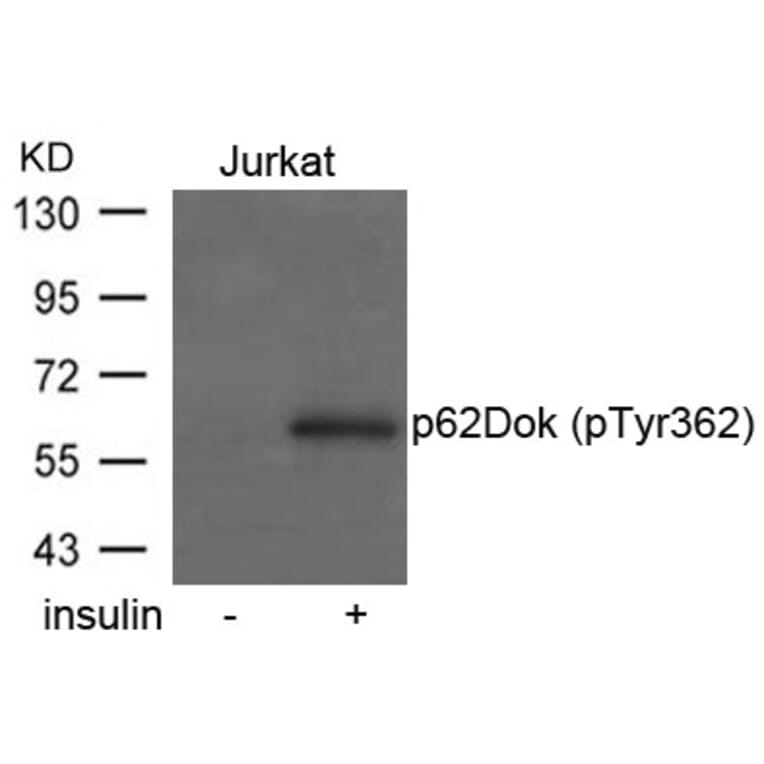 Western blot - p62Dok (phospho-Tyr362) Antibody from Signalway Antibody (11276) - Antibodies.com