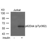 Western blot - p62Dok (phospho-Tyr362) Antibody from Signalway Antibody (11276) - Antibodies.com