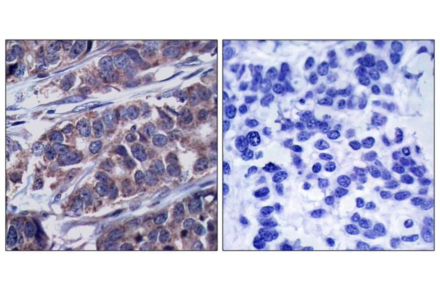 Immunohistochemistry - p62Dok (phospho-Tyr362) Antibody from Signalway Antibody (11276) - Antibodies.com