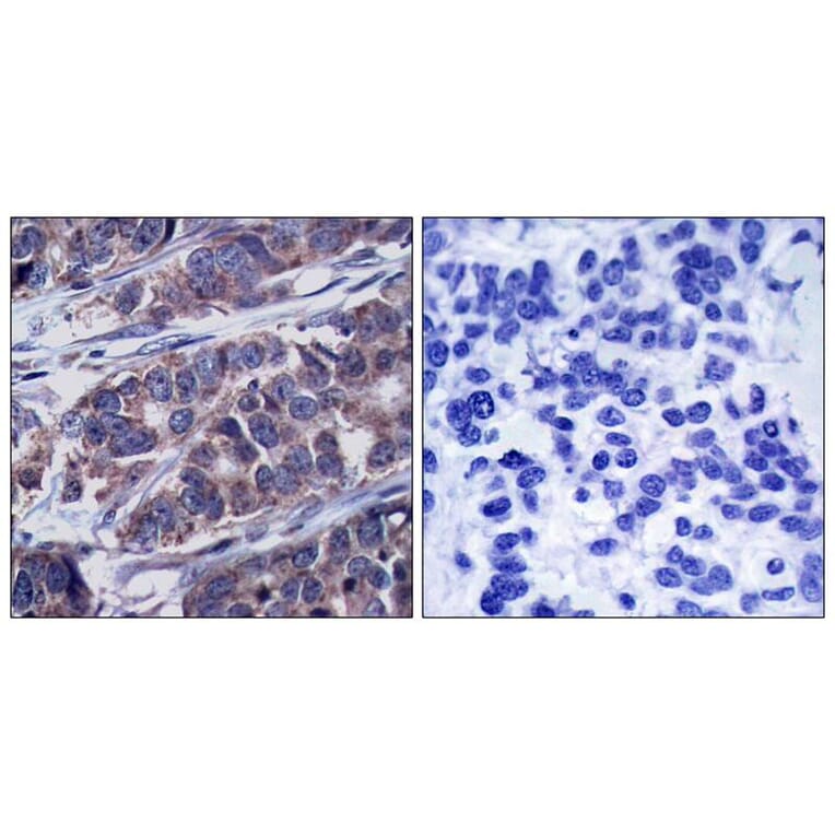 Immunohistochemistry - p62Dok (phospho-Tyr362) Antibody from Signalway Antibody (11276) - Antibodies.com