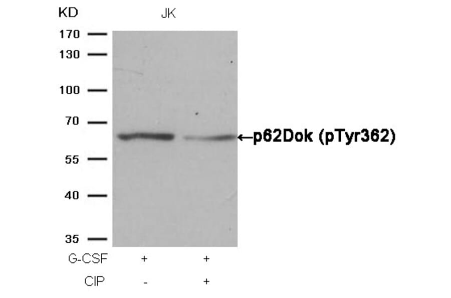 Western blot - p62Dok (phospho-Tyr362) Antibody from Signalway Antibody (11276) - Antibodies.com