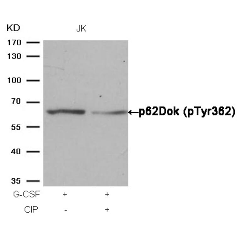 Western blot - p62Dok (phospho-Tyr362) Antibody from Signalway Antibody (11276) - Antibodies.com