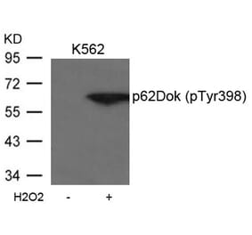 Western blot - p62Dok (phospho-Tyr398) Antibody from Signalway Antibody (11277) - Antibodies.com