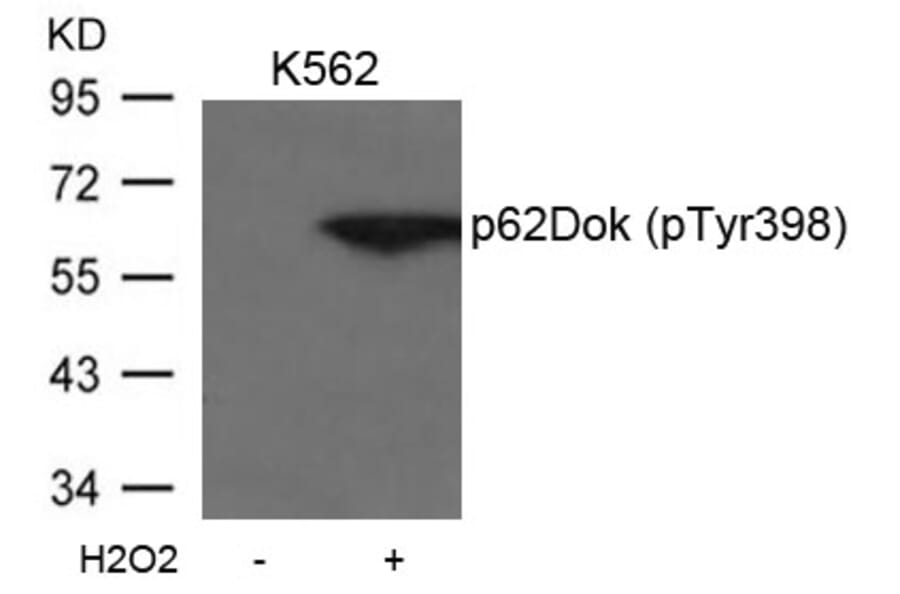 Western blot - p62Dok (phospho-Tyr398) Antibody from Signalway Antibody (11277) - Antibodies.com