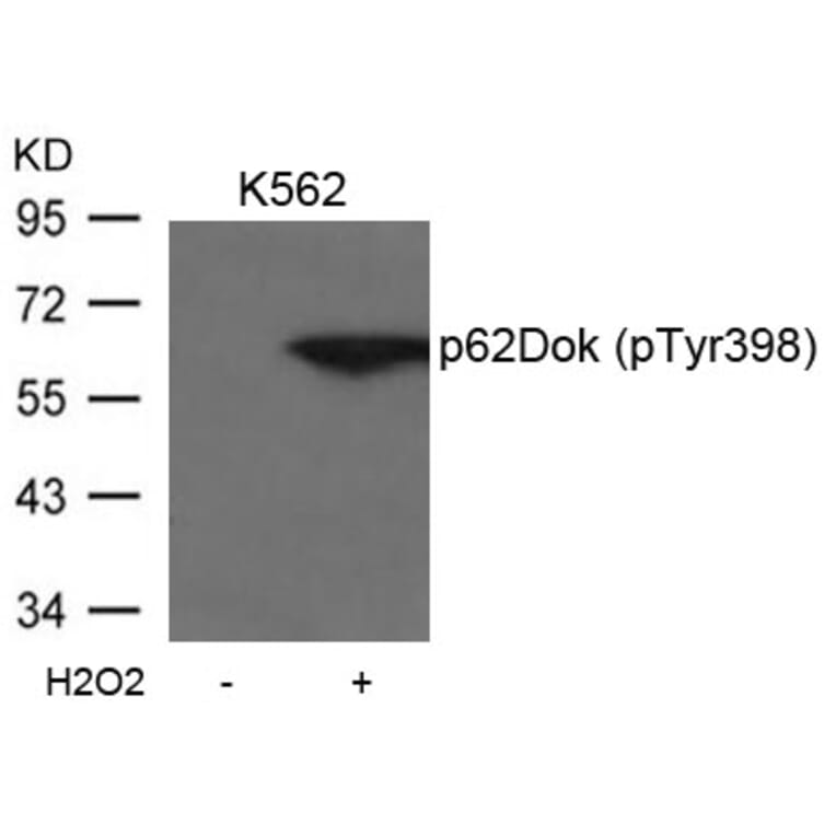 Western blot - p62Dok (phospho-Tyr398) Antibody from Signalway Antibody (11277) - Antibodies.com