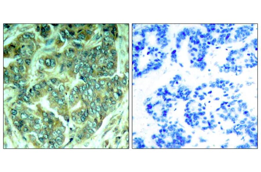 Immunohistochemistry - p62Dok (phospho-Tyr398) Antibody from Signalway Antibody (11277) - Antibodies.com