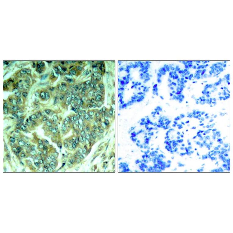 Immunohistochemistry - p62Dok (phospho-Tyr398) Antibody from Signalway Antibody (11277) - Antibodies.com