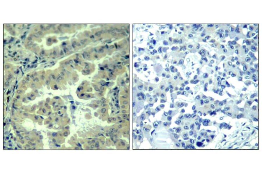 Immunohistochemistry - eIF4G (phospho-Ser1231) Antibody from Signalway Antibody (11514) - Antibodies.com