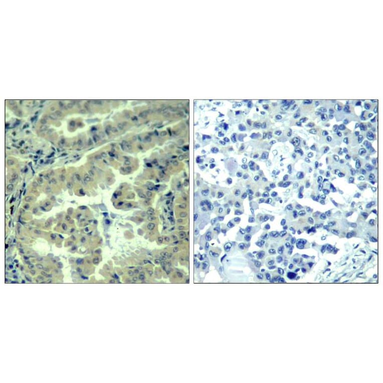 Immunohistochemistry - eIF4G (phospho-Ser1231) Antibody from Signalway Antibody (11514) - Antibodies.com