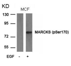 Western blot - MARCKS (phospho-Ser170) Antibody from Signalway Antibody (11535) - Antibodies.com