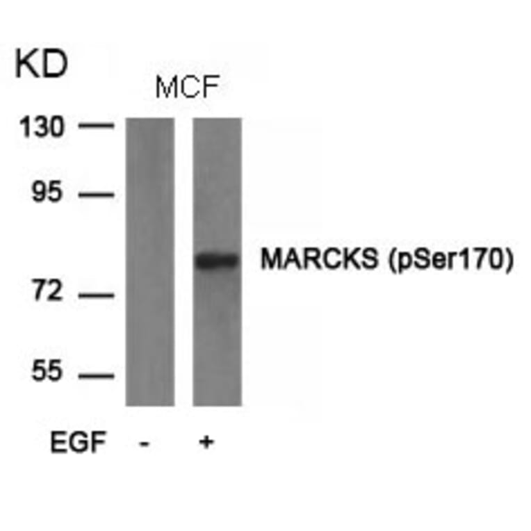 Western blot - MARCKS (phospho-Ser170) Antibody from Signalway Antibody (11535) - Antibodies.com