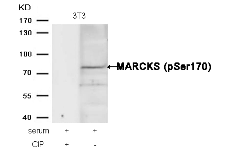Western blot - MARCKS (phospho-Ser170) Antibody from Signalway Antibody (11535) - Antibodies.com