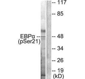 Western blot - C/EBP-α (Phospho-Ser21) Antibody from Signalway Antibody (11648) - Antibodies.com