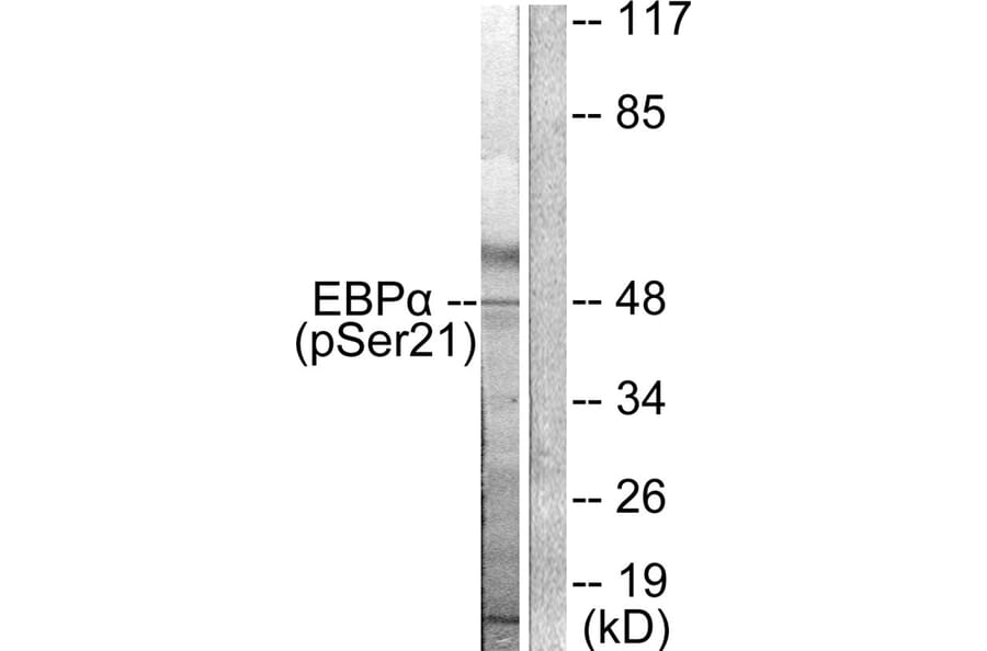 Western blot - C/EBP-α (Phospho-Ser21) Antibody from Signalway Antibody (11648) - Antibodies.com