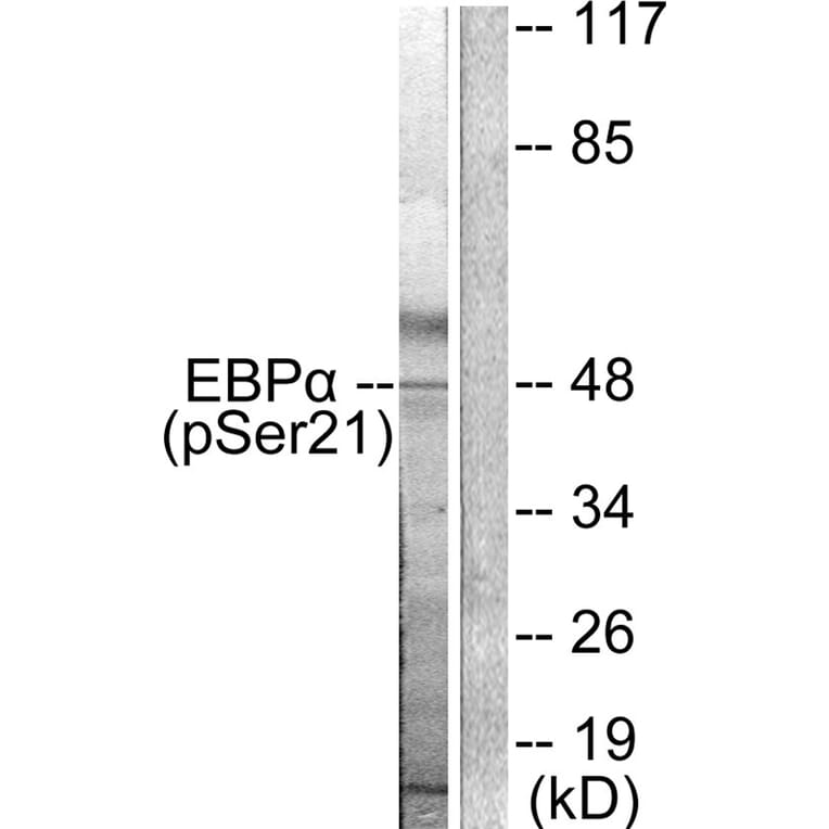 Western blot - C/EBP-α (Phospho-Ser21) Antibody from Signalway Antibody (11648) - Antibodies.com