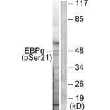 Western blot - C/EBP-α (Phospho-Ser21) Antibody from Signalway Antibody (11648) - Antibodies.com
