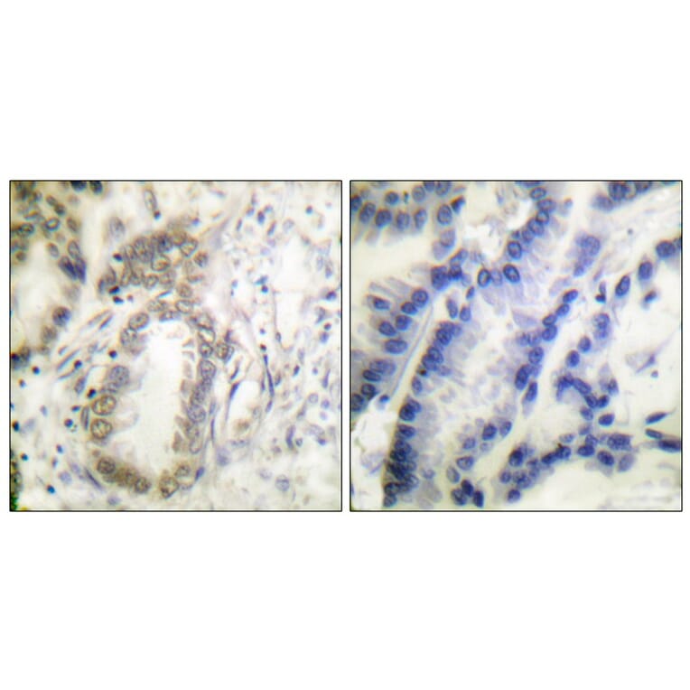 Immunohistochemistry - C/EBP-α (Phospho-Ser21) Antibody from Signalway Antibody (11648) - Antibodies.com