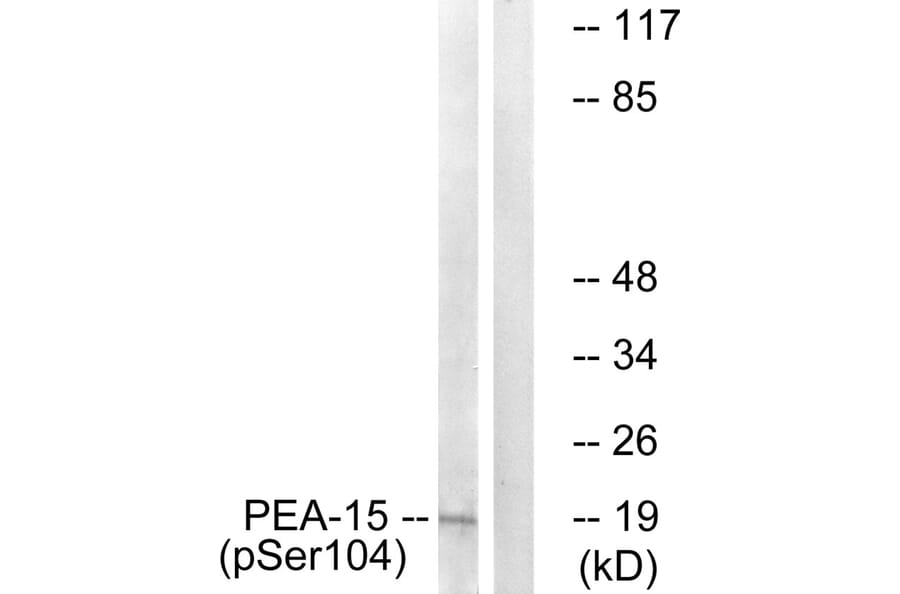 Western blot - PEA-15 (Phospho-Ser104) Antibody from Signalway Antibody (11676) - Antibodies.com