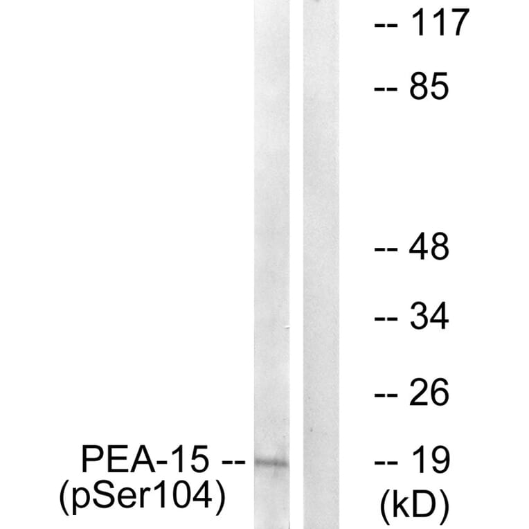 Western blot - PEA-15 (Phospho-Ser104) Antibody from Signalway Antibody (11676) - Antibodies.com
