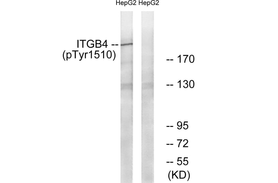 Western blot - ITGB4 (Phospho-Tyr1510) Antibody from Signalway Antibody (11698) - Antibodies.com