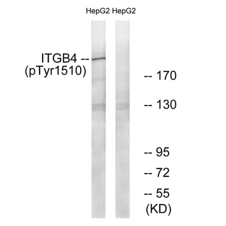 Western blot - ITGB4 (Phospho-Tyr1510) Antibody from Signalway Antibody (11698) - Antibodies.com