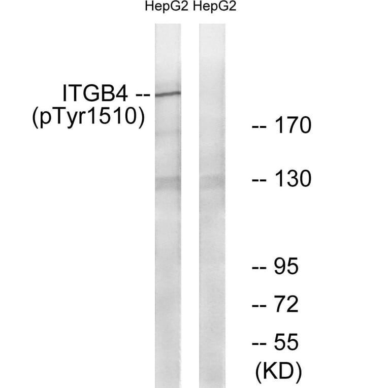 Western blot - ITGB4 (Phospho-Tyr1510) Antibody from Signalway Antibody (11698) - Antibodies.com