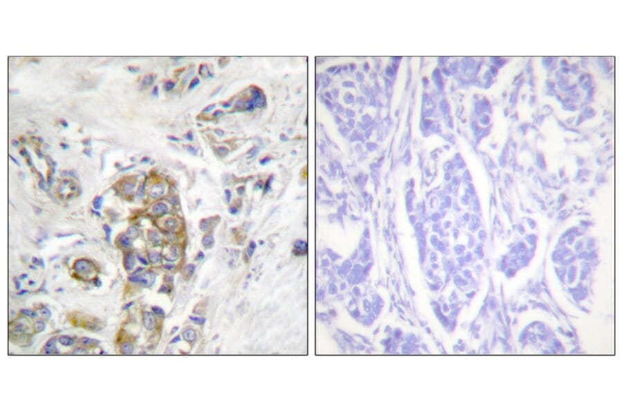Immunohistochemistry - ITGB4 (Phospho-Tyr1510) Antibody from Signalway Antibody (11698) - Antibodies.com