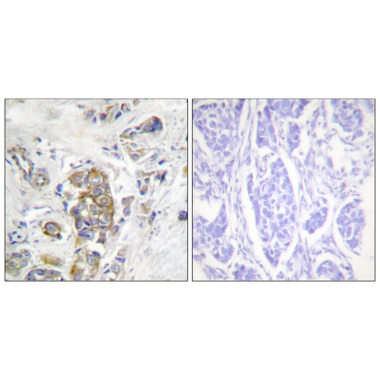 Immunohistochemistry - ITGB4 (Phospho-Tyr1510) Antibody from Signalway Antibody (11698) - Antibodies.com