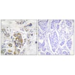 Immunohistochemistry - ITGB4 (Phospho-Tyr1510) Antibody from Signalway Antibody (11698) - Antibodies.com