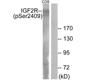 Western blot - IGF2R (Phospho-Ser2409) Antibody from Signalway Antibody (11708) - Antibodies.com