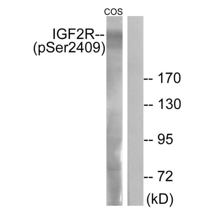 Western blot - IGF2R (Phospho-Ser2409) Antibody from Signalway Antibody (11708) - Antibodies.com