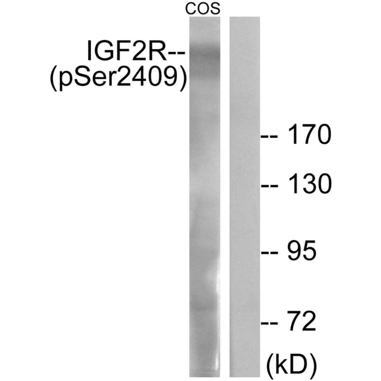 Western blot - IGF2R (Phospho-Ser2409) Antibody from Signalway Antibody (11708) - Antibodies.com