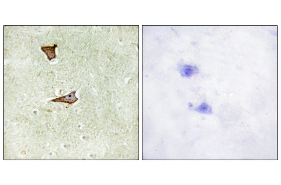 Immunohistochemistry - IGF2R (Phospho-Ser2409) Antibody from Signalway Antibody (11708) - Antibodies.com