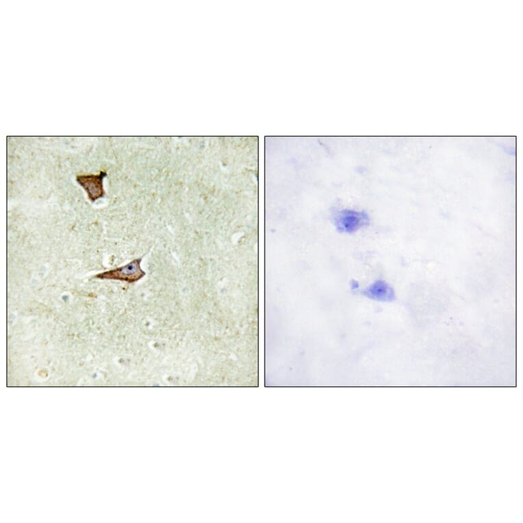 Immunohistochemistry - IGF2R (Phospho-Ser2409) Antibody from Signalway Antibody (11708) - Antibodies.com