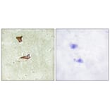 Immunohistochemistry - IGF2R (Phospho-Ser2409) Antibody from Signalway Antibody (11708) - Antibodies.com