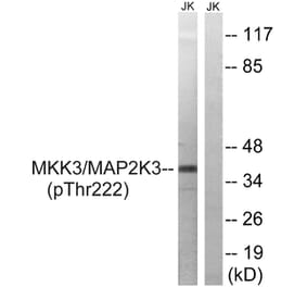 Western blot - MAP2K3 (Phospho-Thr222) Antibody from Signalway Antibody (11741) - Antibodies.com