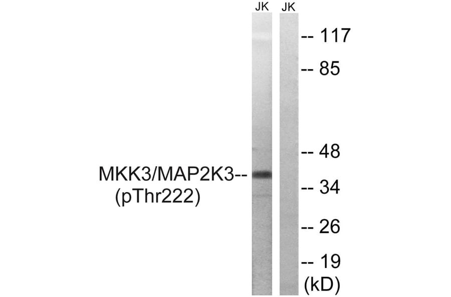 Western blot - MAP2K3 (Phospho-Thr222) Antibody from Signalway Antibody (11741) - Antibodies.com