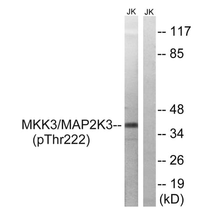 Western blot - MAP2K3 (Phospho-Thr222) Antibody from Signalway Antibody (11741) - Antibodies.com