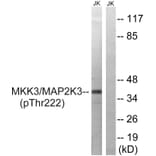 Western blot - MAP2K3 (Phospho-Thr222) Antibody from Signalway Antibody (11741) - Antibodies.com
