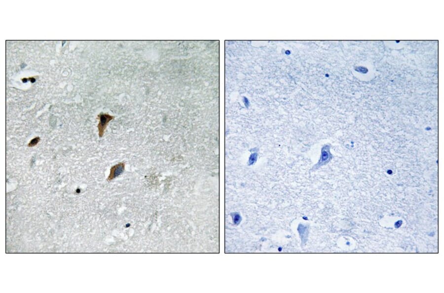 Immunohistochemistry - MAP2K3 (Phospho-Thr222) Antibody from Signalway Antibody (11741) - Antibodies.com