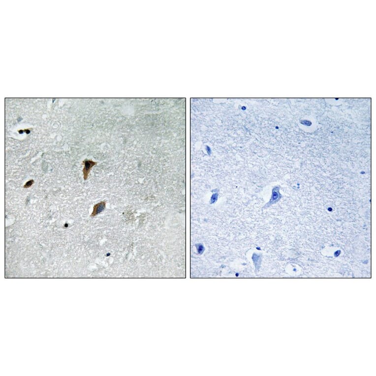Immunohistochemistry - MAP2K3 (Phospho-Thr222) Antibody from Signalway Antibody (11741) - Antibodies.com