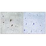 Immunohistochemistry - MAP2K3 (Phospho-Thr222) Antibody from Signalway Antibody (11741) - Antibodies.com