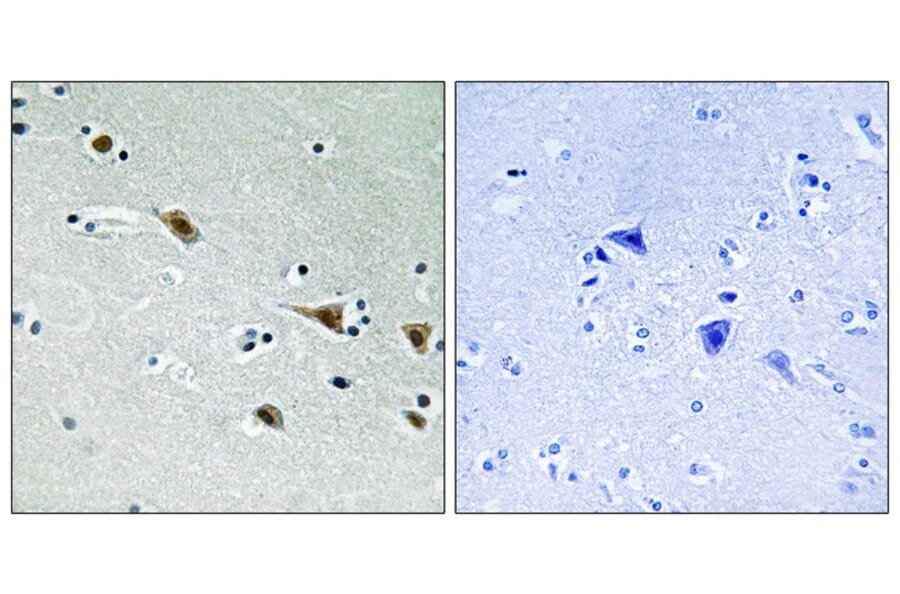 Immunohistochemistry - MAP2K7 (Phospho-Ser271) Antibody from Signalway Antibody (11742) - Antibodies.com