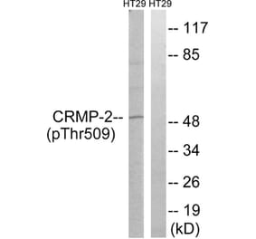 Western blot - CRMP-2 (Phospho-Thr509) Antibody from Signalway Antibody (11795) - Antibodies.com
