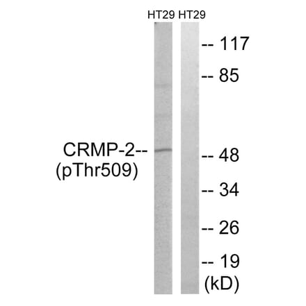 Western blot - CRMP-2 (Phospho-Thr509) Antibody from Signalway Antibody (11795) - Antibodies.com