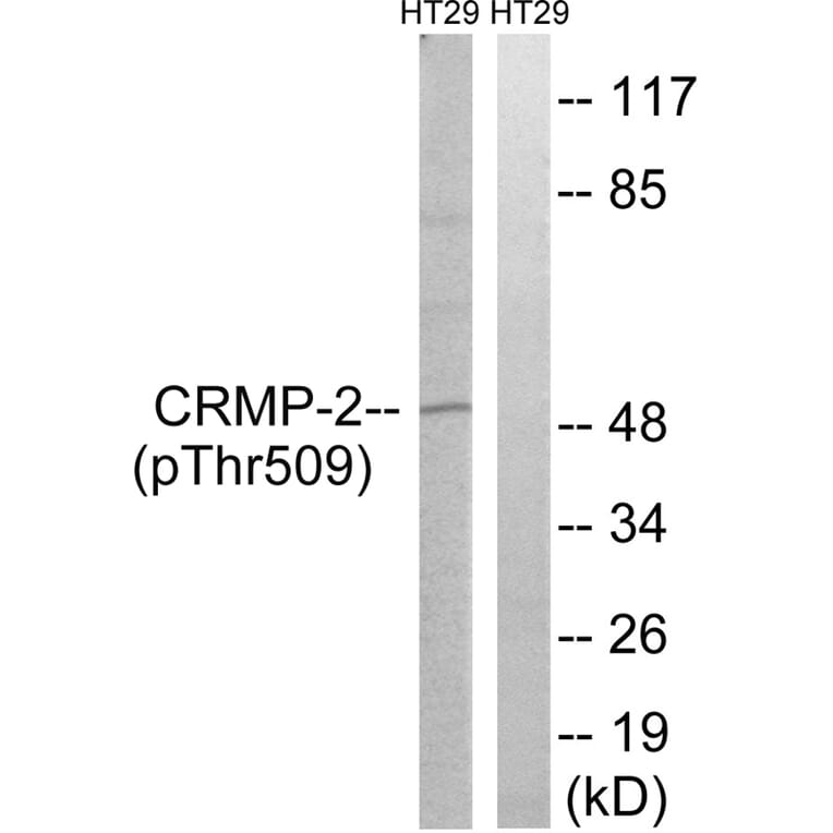 Western blot - CRMP-2 (Phospho-Thr509) Antibody from Signalway Antibody (11795) - Antibodies.com