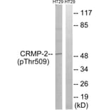 Western blot - CRMP-2 (Phospho-Thr509) Antibody from Signalway Antibody (11795) - Antibodies.com