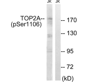 Western blot - TOP2A (Phospho-Ser1106) Antibody from Signalway Antibody (12110) - Antibodies.com