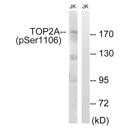 Western blot - TOP2A (Phospho-Ser1106) Antibody from Signalway Antibody (12110) - Antibodies.com