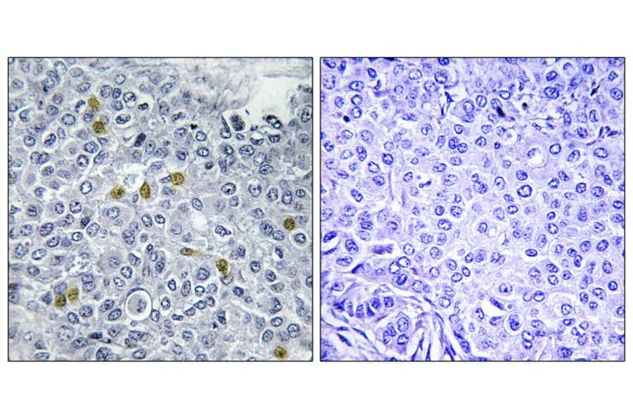 Immunohistochemistry - TOP2A (Phospho-Ser1106) Antibody from Signalway Antibody (12110) - Antibodies.com